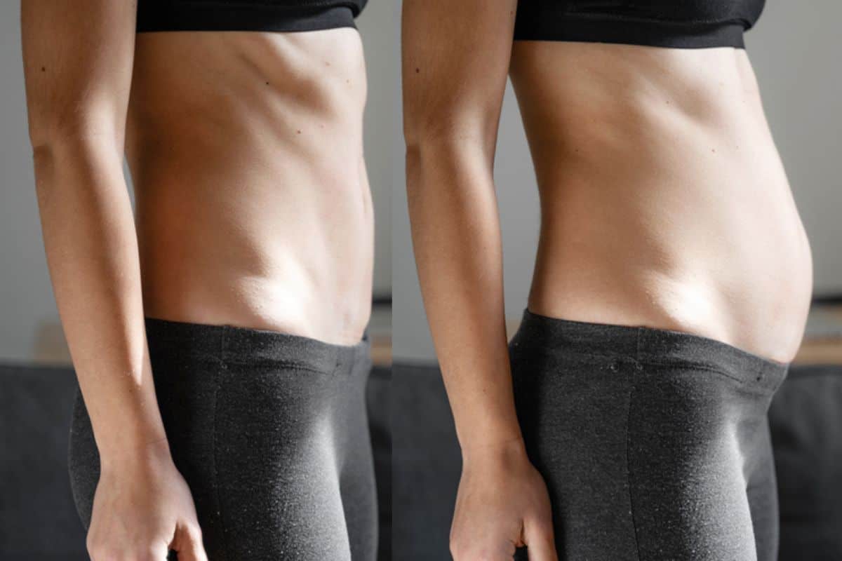 How long does diastasis recti take to improve White City?