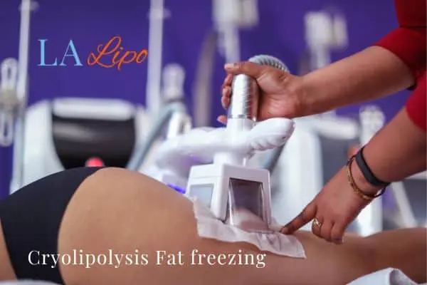 women getting fat freezing White City