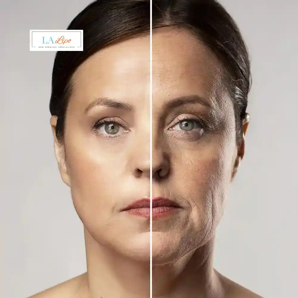 How Can You Tell If Non-Surgical Skin Tightening Is Right for You White City?