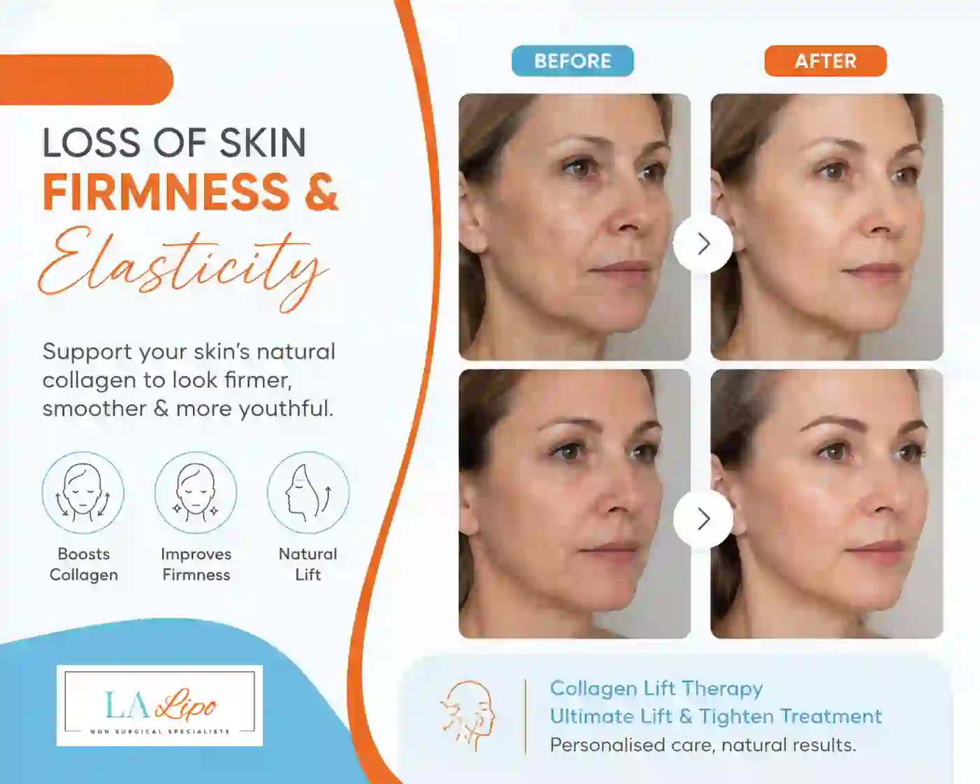 Sign #7: Loss of Skin Firmness and Elasticity White City