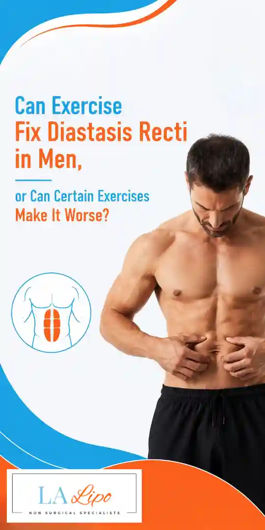 Can Exercise Fix Diastasis Recti in Men, or Can Certain Exercises Make It Worse White City?